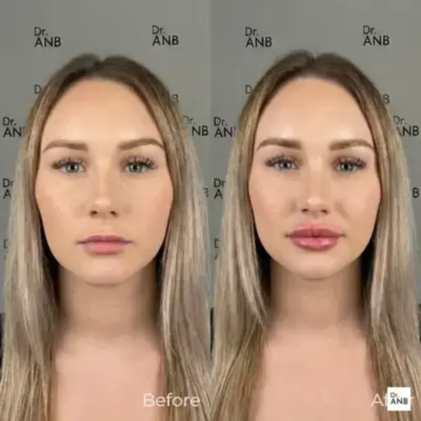 Doku ve Form Uygulamaları before-after 2